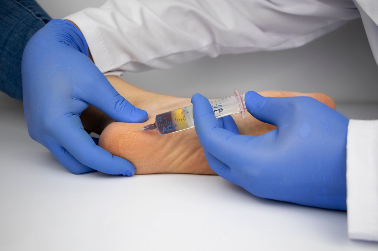 Revolutionary PRP Platelet-Rich Plasma Therapy in Colorado: A Game-Changer for Foot and Ankle Care