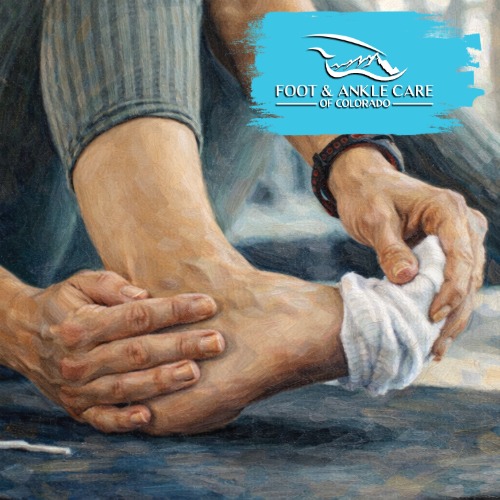 Achilles Tendinitis From Sports Injuries: How Foot & Ankle Care Of Colorado Can Help