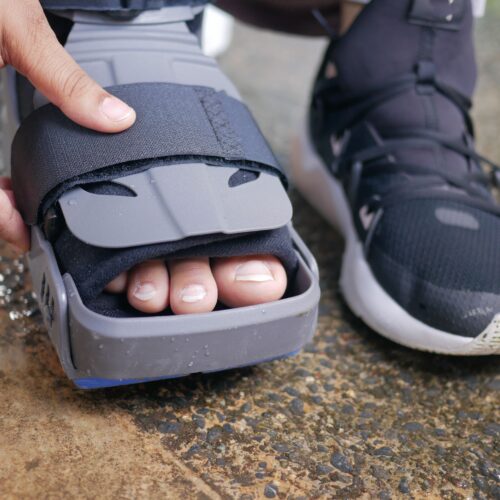 foot pain