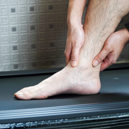 sports injuries