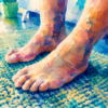 Essential Diabetic Foot Care